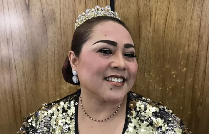 Nunung Stres Bolak-balik Solo-Jakarta untuk Berobat juga Bekerja hingga Idap Asam Lambung Kronis